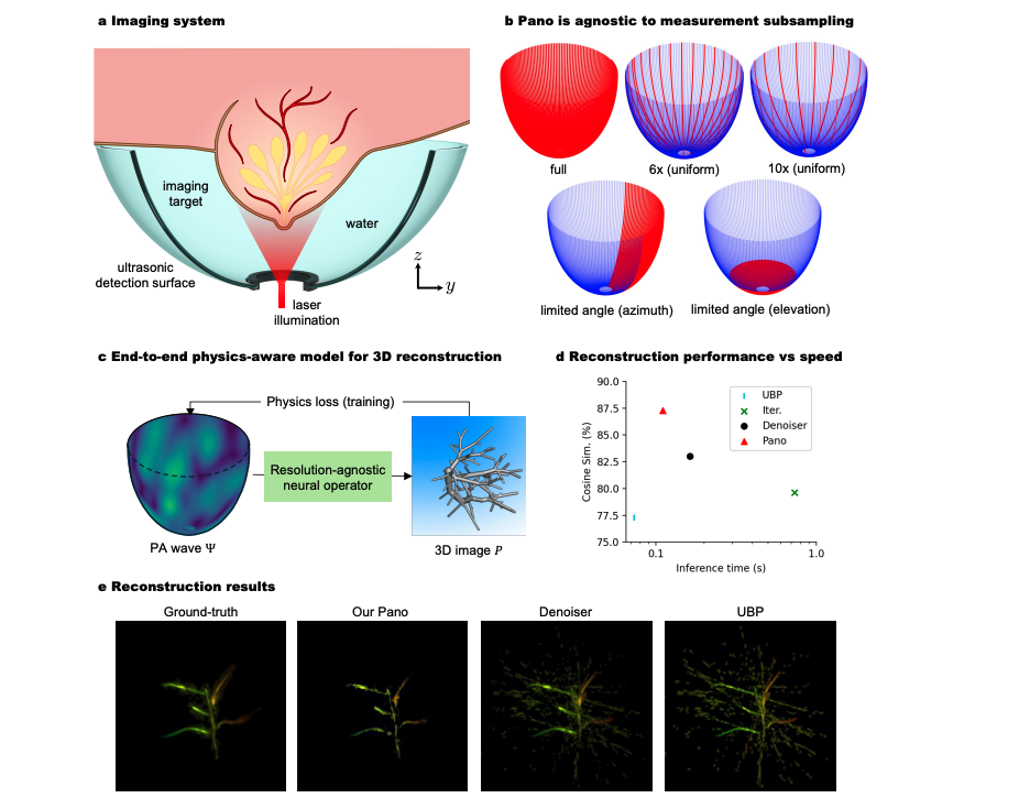 AI Speeds 3D Photoacoustic Deep-Tissue Imaging