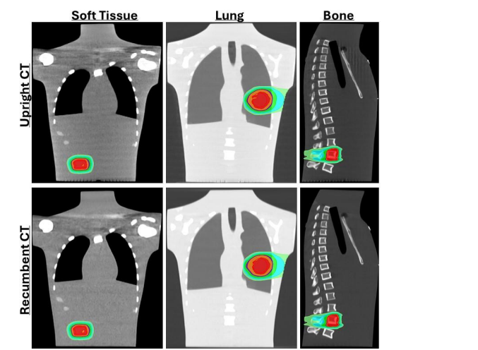 Upright CT System Achieves 99.8% Accuracy for Radiotherapy Planning and 3% Spatial Integrity at 100mm