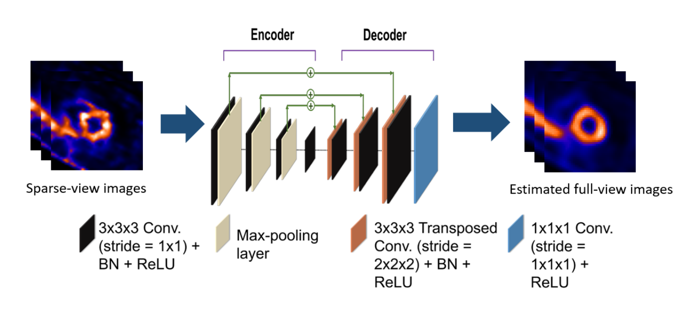 Spasht Enhances Sparse-view MPI SPECT, Improving Perfusion Defect Detection and Reducing Scanning Time