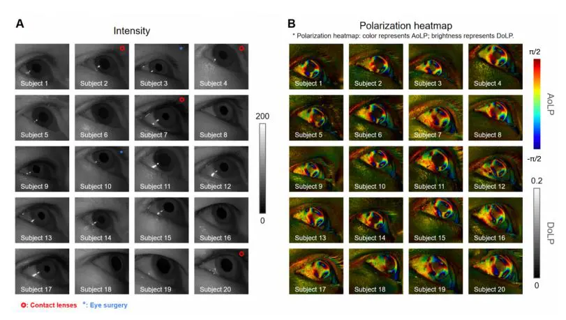 Polarization-resolved Imaging Reduces Gaze Error by 10, 16% and Improves Eye Tracking Precision