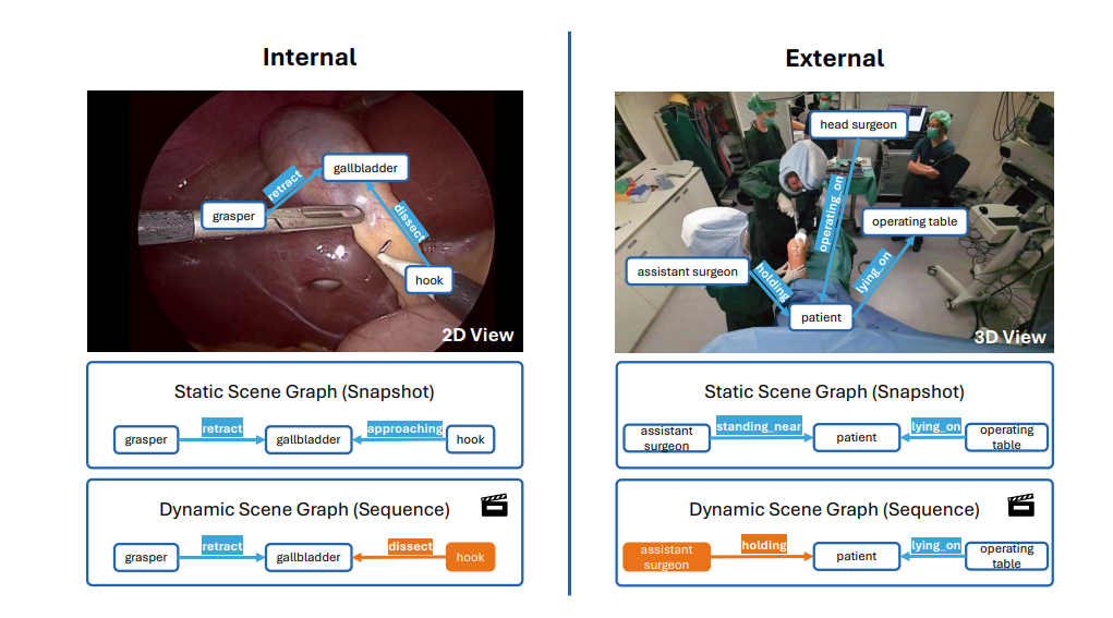 Scene Graphs in Surgery Demonstrate a Data Divide Between 2D Video and 4D Modeling