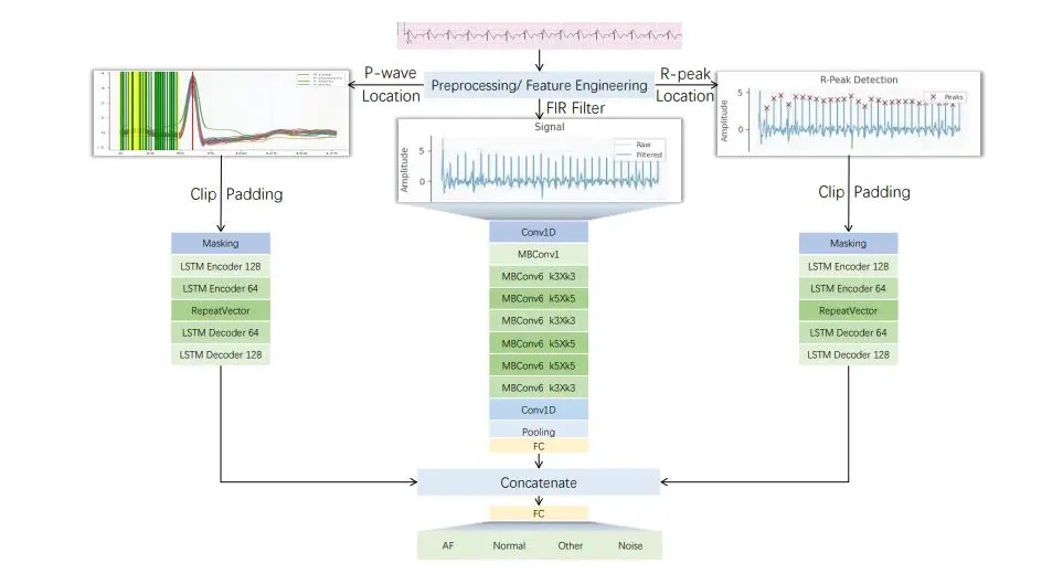 Efficientecg: Deep Learning Enables Accurate, Rapid Electrocardiogram Classification for Reduced Diagnostic Burden