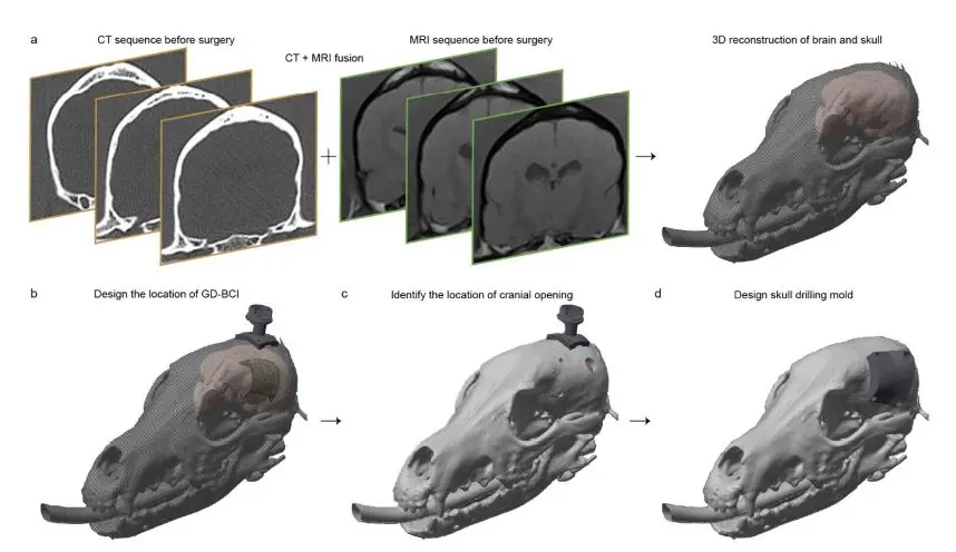 Guidewire-driven ECoG Arrays Deploy 256 Electrodes across 4 Cm2 for Large-area Brain-computer Interface Applications