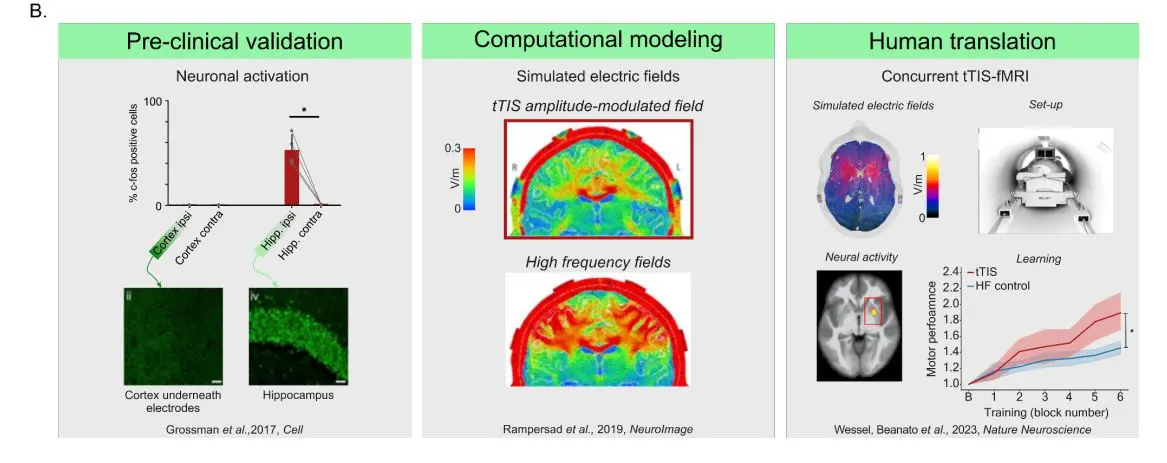 Transcranial Temporal Interference Stimulation Enables Focal Deep Brain Neuromodulation in Humans
