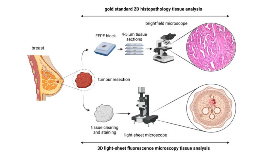 Light-sheet Microscopy Assesses Cancer Pathology, Enabling High-throughput, Three-dimensional Imaging of Intact Specimens