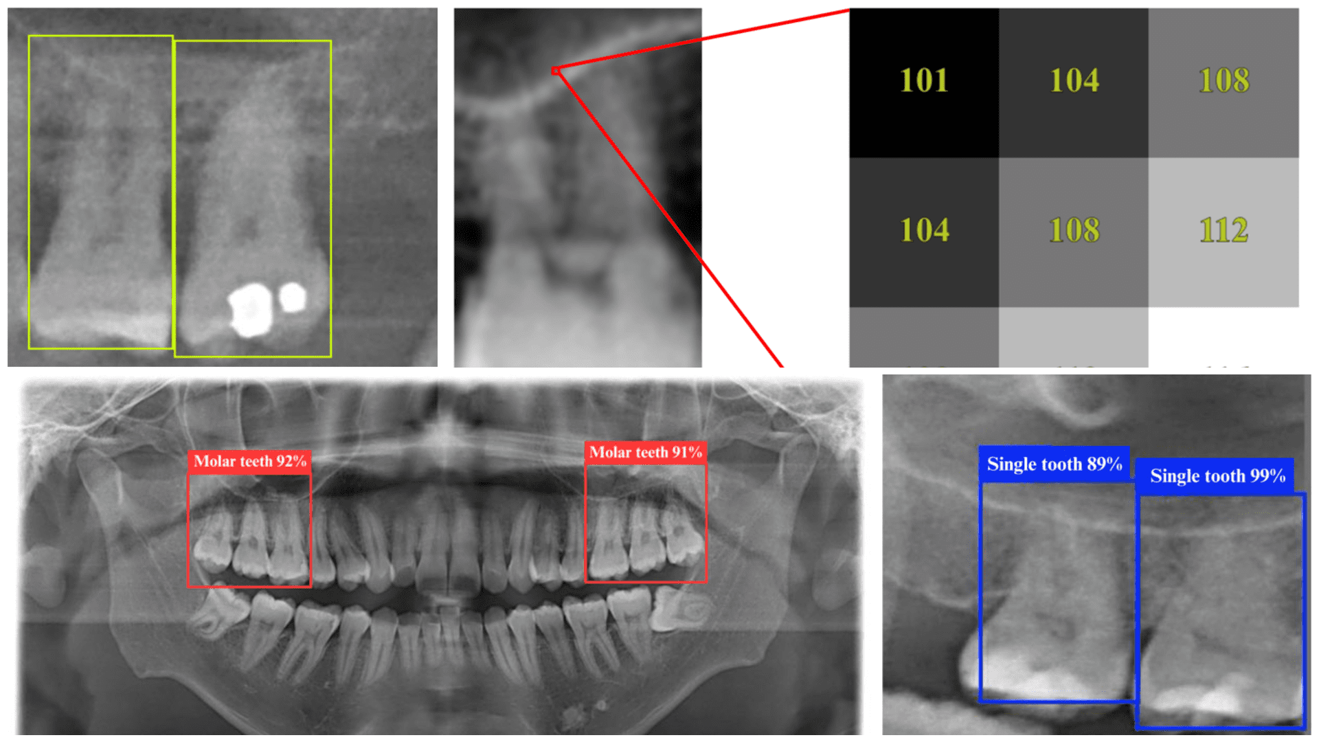 AI Detects Sinusitis on X-rays with 98.2% Accuracy