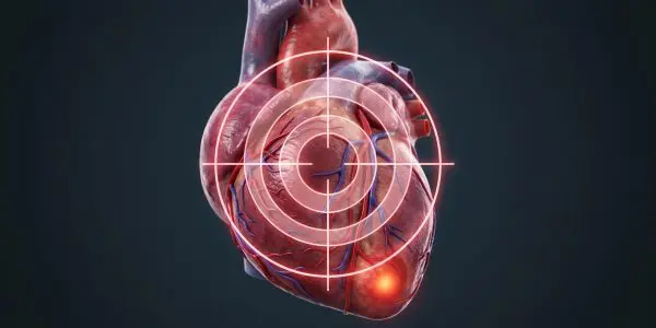 FAU’s quantum model predicts heart disease with 90% accuracy