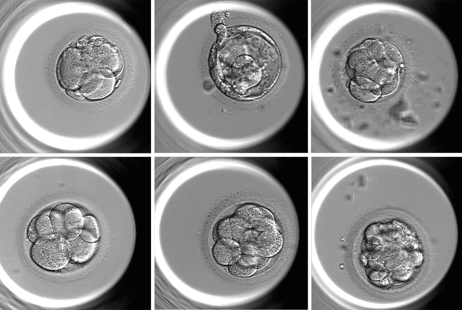 AI System Accurately Assesses IVF Embryo Quality Without Human Bias