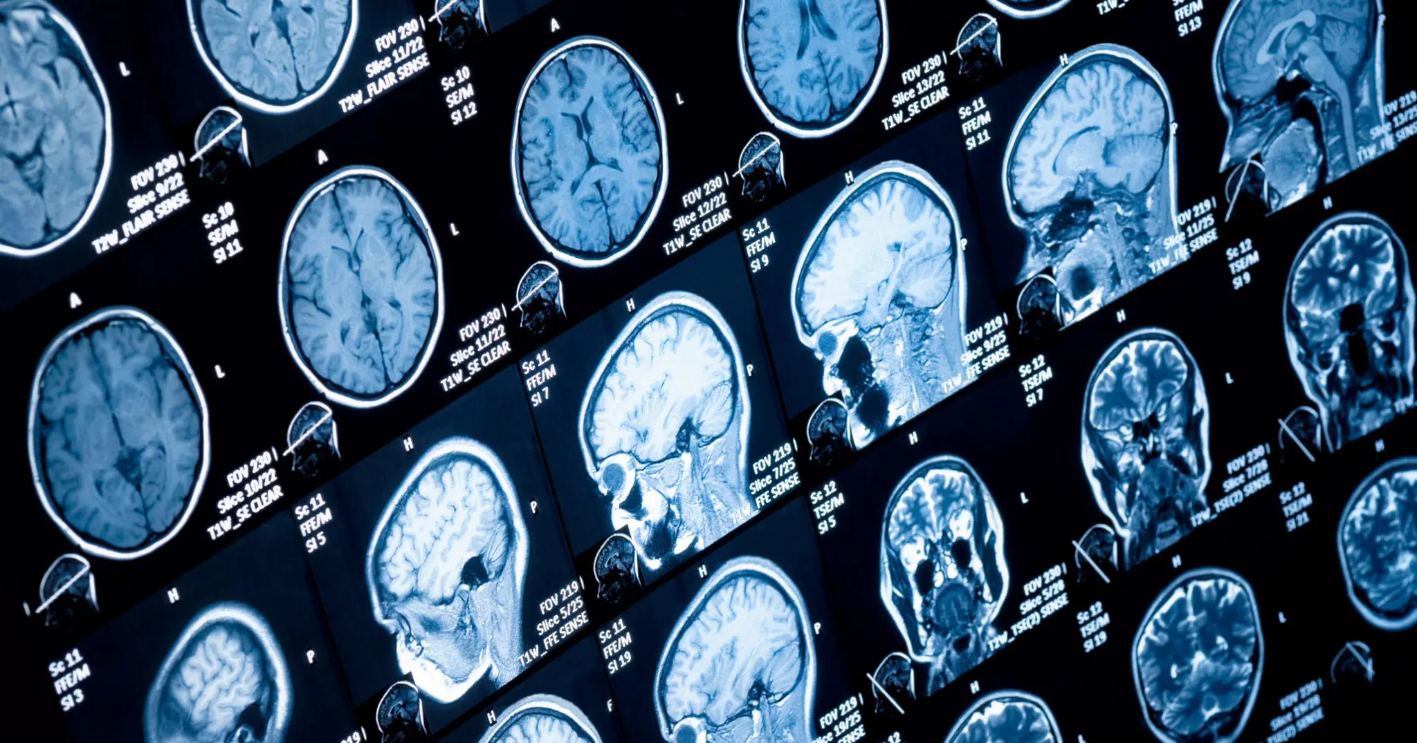 Newcastle University Receives £1.2M to Model Emotional Memory with Quantum Maths