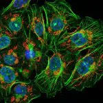 A colony of fluorescently stained cells with blue nuclei, green filaments and red mitochondria on black