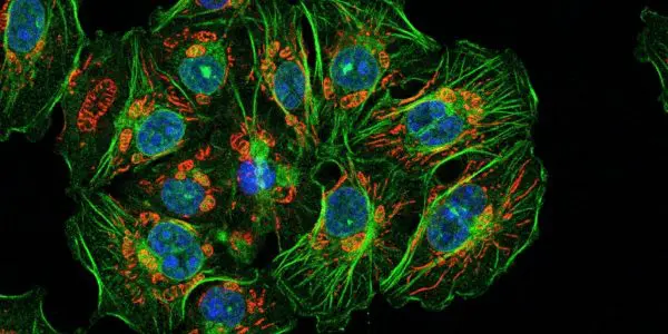 A colony of fluorescently stained cells with blue nuclei, green filaments and red mitochondria on black