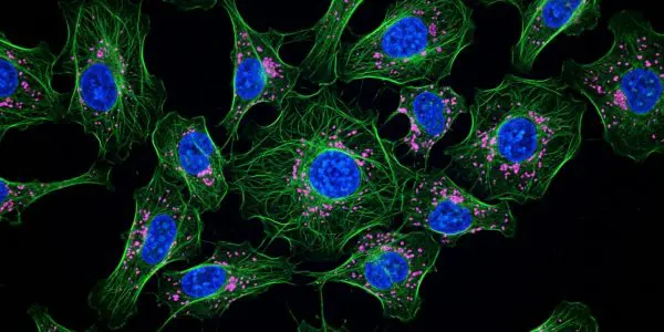 Researchers Link Light and Sound for Nanoscale Imaging