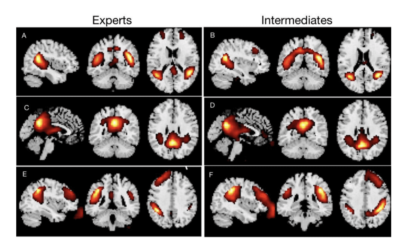 Brain Scans Reveal Secrets of AI Prompt Experts