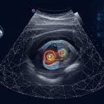 Stochastic Kinetic Models: Gradient-Based Optimisation Accurately Recovers Rates