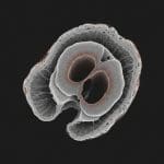 Quantitative Absorption Tomography Achieves 3D Volumetric Imaging from Brightfield Microscopy