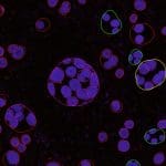 Panopmamba Achieves Enhanced Nuclei Panoptic Segmentation for Improved Cancer Diagnostics