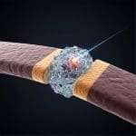 Photonic Crystal Nanolasers Achieve Biointegration with Minimal 30 Μm2 Footprint