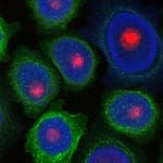 Oregon State University Nanoagent Achieves Total Cancer Regression in Mouse Trials