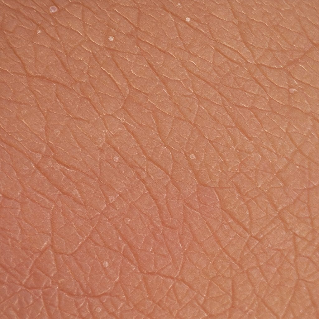 Quantum-enhanced image generation improves skin disease diagnosis and data augmentation.